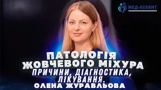 Патологія жовчевого міхура | терапевт пульмонолог Олена Журавльова | Мед-Атлант