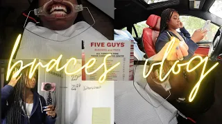 vlog | come with me to get braces for the first time: pain level, braces appointment, food, target..