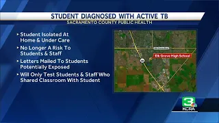 Elk Grove High School student diagnosed with active tuberculosis