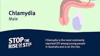 Sexual Health - Chlamydia (Male)