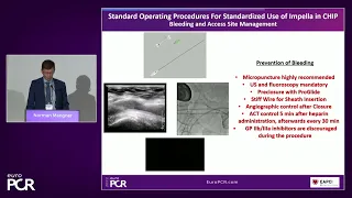 Tailored support for complex PCI and AMI with percutaneous mechanical circulatory support
