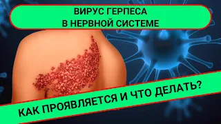 ВИРУС ГЕРПЕСА И НЕРВНАЯ СИСТЕМА: как они связаны?