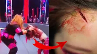 Nia jax injured Kairi Sane AGAIN!!!| Nia Jax botch on RAW