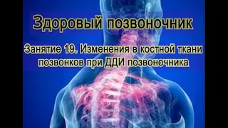 Занятие 19. Изменения в костях позвонков при дегенеративно-дистрофических поражениях позвоночника