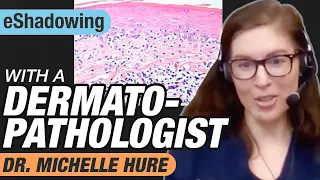 Online Shadowing With a Dermatopathologist: Dr. Michelle Hure | eShadowing Ep. 2