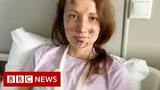 Russian woman rescued from bomb site in Ukraine - BBC News