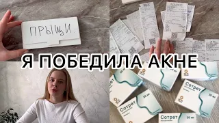 Я победила акне | системные ретиноиды | ежедневный уход | чистки и пилинги | моя история