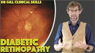 How To Use An Ophthalmoscope To Check For Diabetic Retinopathy - Dr Gill