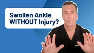 What Causes Ankle Pain and Swelling WITHOUT Injury?