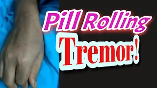 Pill rolling tremor ||Pill rolling movement || Parkinson's Disease || Parkinsonism