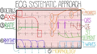 ECG Interpretation Made Easy (Learn How to Interpret an ECG in 13 Minutes)