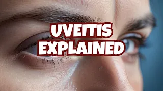 Anterior uveitis, posterior uveitis and panuveitis: etiology, symptoms, diagnosis and treatment