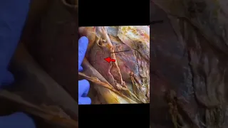 Diástase Abdominal - Anatomia