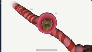 Understanding an Asthma Attack