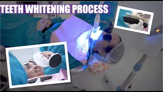 Teeth Whitening Process | Apostol Dental Philippines