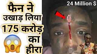 OMG ! फैन ने निकाल लिया 175 crore का हीरा 😱 | Lil Uzi Vert diamond getting removed  #shorts