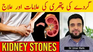 Gurde Mein Pathri Ki Alamat, Gurday Ka Dard, Gurde me Stone (Kidney Stones) Ka Ilaj, Pathri Ka Ilaaj