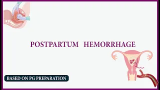 postpartum haemorrhage | NEET PG