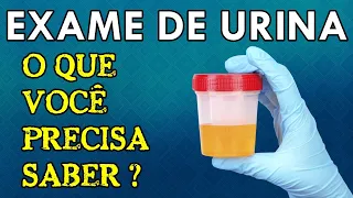 Como INTERPRETAR o Exame de URINA