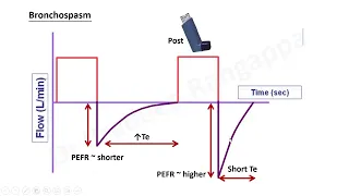 Flow dynamics in Mechanical Ventilation ~ Physics, identification of pathologies, asynchronies etc..