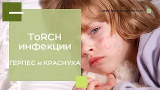 ToRCH-инфекции / КРАСНУХА / ГЕРПЕС и остальные
