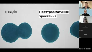 Особистість та стрес війни: результати психологічного дослідження. Вебінар від 26/10/2022