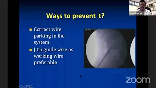 Tract Loss in PCNL || Urology ||