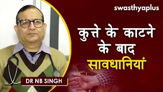 कुत्ते के काटने के बाद सावधानियां | Dr NB Singh on Dog Bite in Hindi | First Aid & Treatment