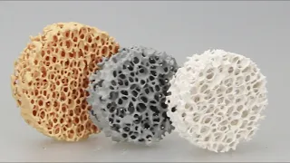 High-Temperature Filtration with Silicon Carbide Ceramic Foam Filters