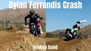 Crash from Dylan Ferrandis yesterday practicing // Broken Hand 😬
