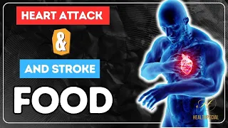 10 Food to Prevent Heart Attack and Stroke