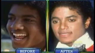 Michael Jackson: Too Much Plastic Surgery?