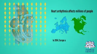 Heart Arrhythmia, Causes, Signs and Symptoms, Diagnosis and Treatment.