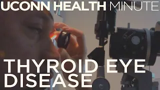 UConn Health Minute: Thyroid Eye Disease