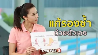 แก้อาการรองช้ำด้วยตัวเอง : ปรับก่อนป่วย (18 ธ.ค. 61)