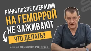 РАНЫ после ОПЕРАЦИИ на ГЕМОРРОЙ не заживают. Что делать?