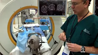 Lab Demo: Placement of NeuroPace RNS for Epilepsy - Ryder Gwinn, MD