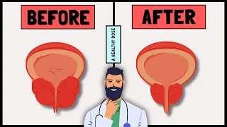 How to Shrink an Enlarged Prostate?