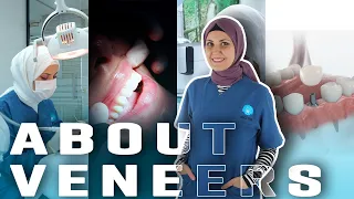 Learn Veneers From Our Doctor | INCI DENTAL CLINIC
