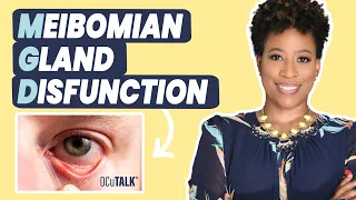 Meibomian Gland Dysfunction (MGD) and Dry Eyes with Dr. Janelle Davison