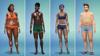 The Sims 4 Adds Vitiligo Skin Feature in Free Update Today