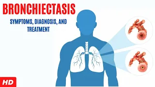 Bronchiectasis: Symptoms, Diagnosis and Treatment