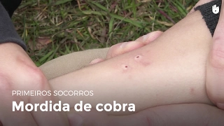 Mordida de cobra | Primeiros socorros