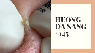 #145 | Huong Da Nang