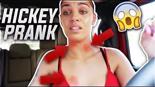 HICKEY PRANK ON HUSBAND!! **HE WAS PISSED**