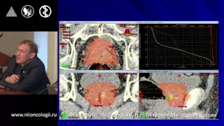 Стереотаксическая лучевая терапия. Новиков С.Н. Часть 2