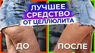 Как избавиться от ЦЕЛЛЮЛИТА? / Способ РАБОТАЕТ на 100%