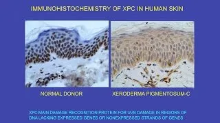 CARTA: Unique Features of Human Skin – Ultraviolet Radiation: Effects on DNA and Carcinogenesis