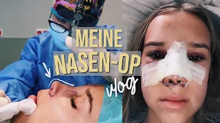 Meine Nasen OP! Vlog //Hannah