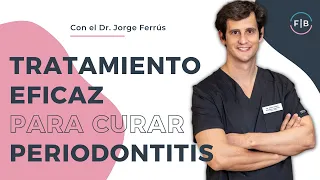 👉 PERIODONTITIS o PIORREA: Tratamiento eficaz para CURAR tus ENCÍAS 👄